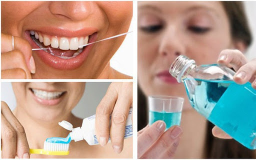 chăm sóc răng sau dán sứ veneer