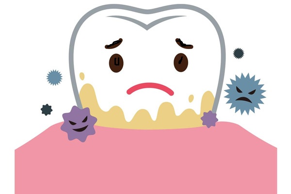 Răng xuất hiện đốm trắng là do nguyên nhân gì?