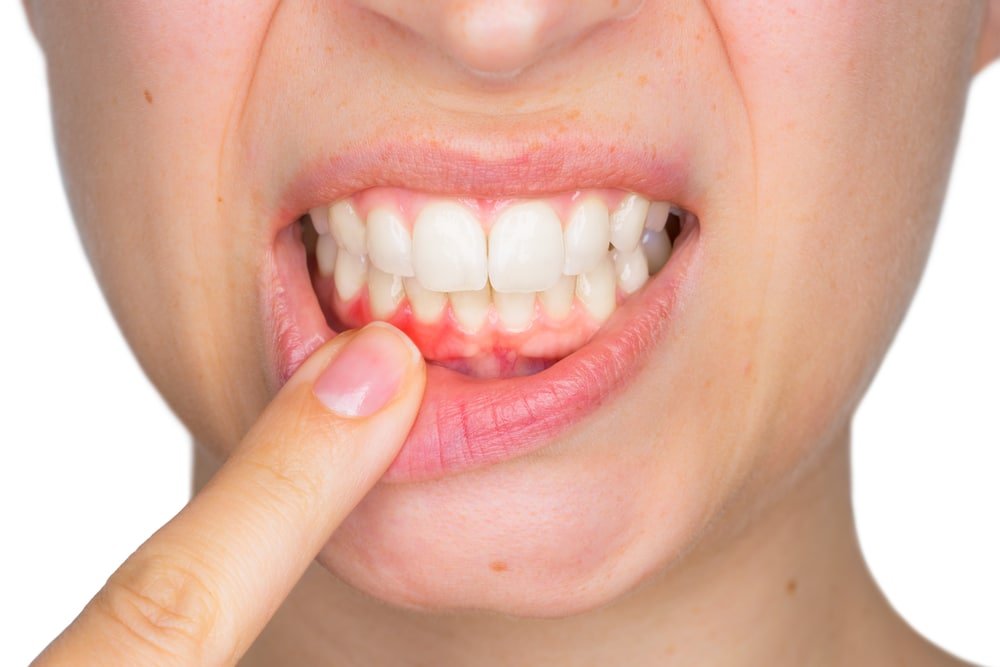 Top những vấn đề về răng miệng