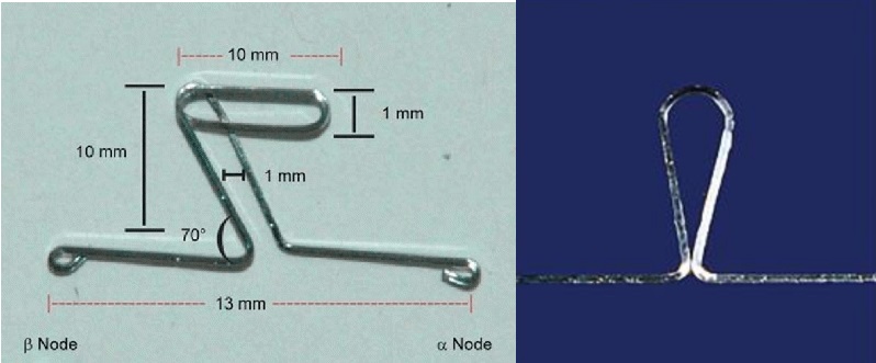 Loop chỉnh nha - Sơ lược về loop trong chỉnh nha có gì đáng đọc!