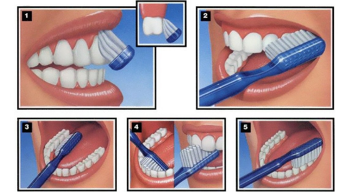 Đánh răng đúng cách - Vì sao cần phải vệ sinh răng miệng đúng cách?