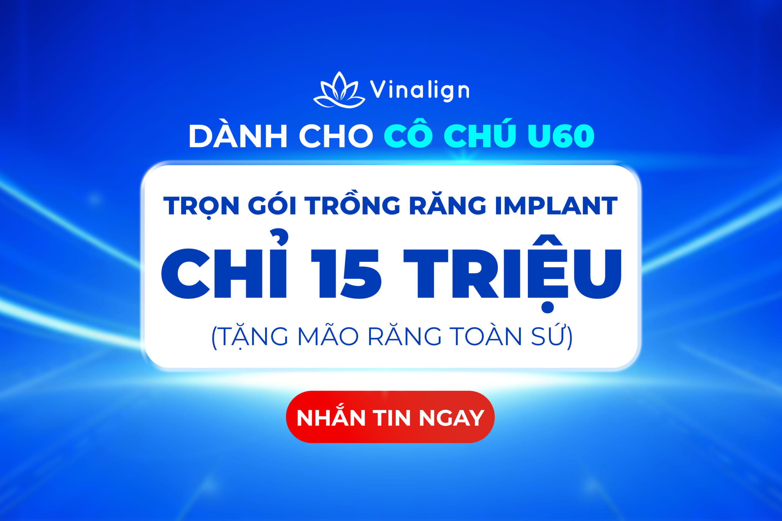 ƯU ĐÃI DỊCH VỤ IMPLANT