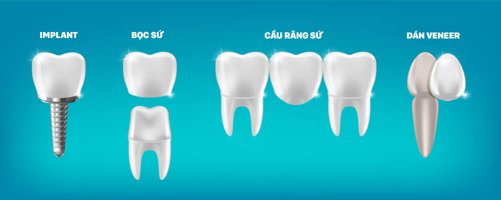 phục hình răng
